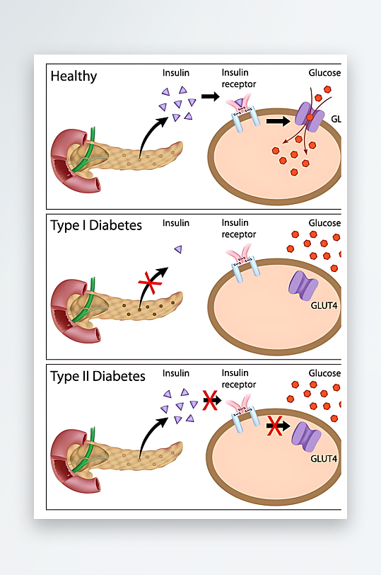 医学医疗人体示意图-众图网