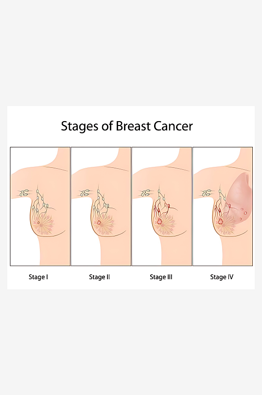 医学医疗人体示意图-众图网