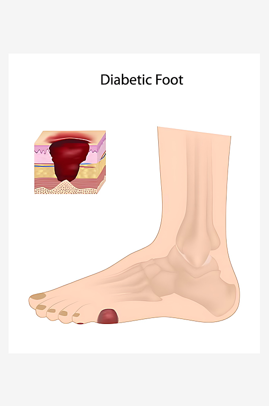 医学医疗人体示意图-众图网
