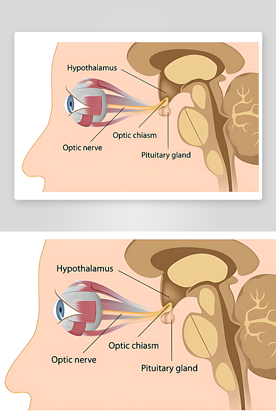 医学医疗人体示意图-众图网
