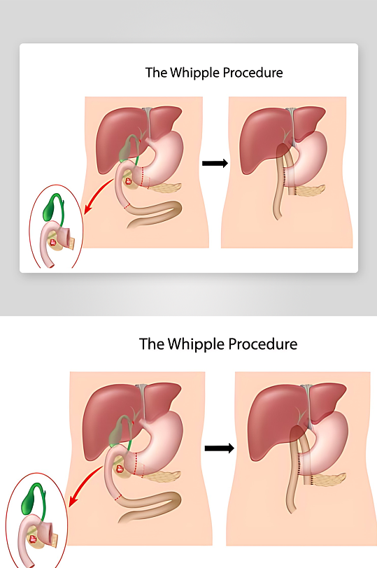 医学医疗人体示意图-众图网