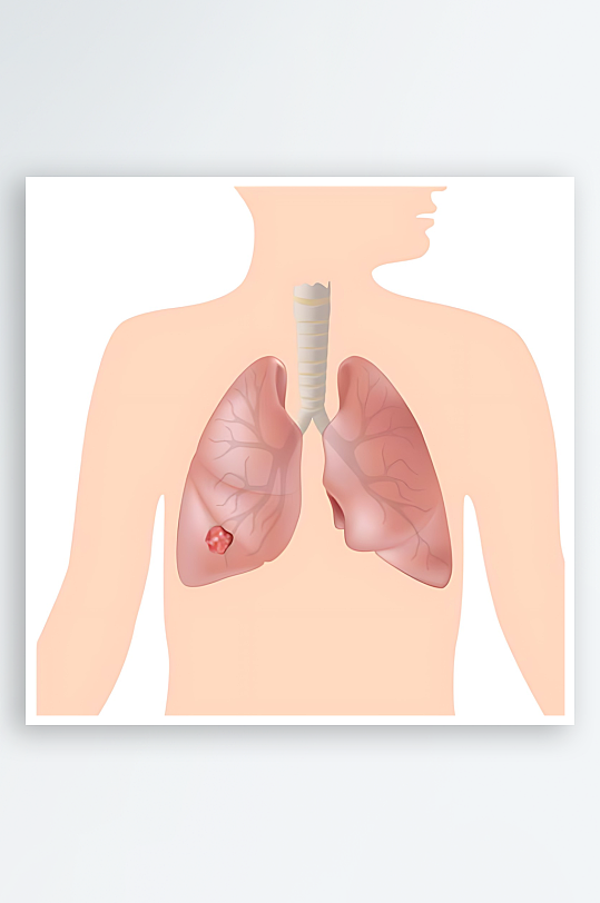 医学医疗人体示意图-众图网