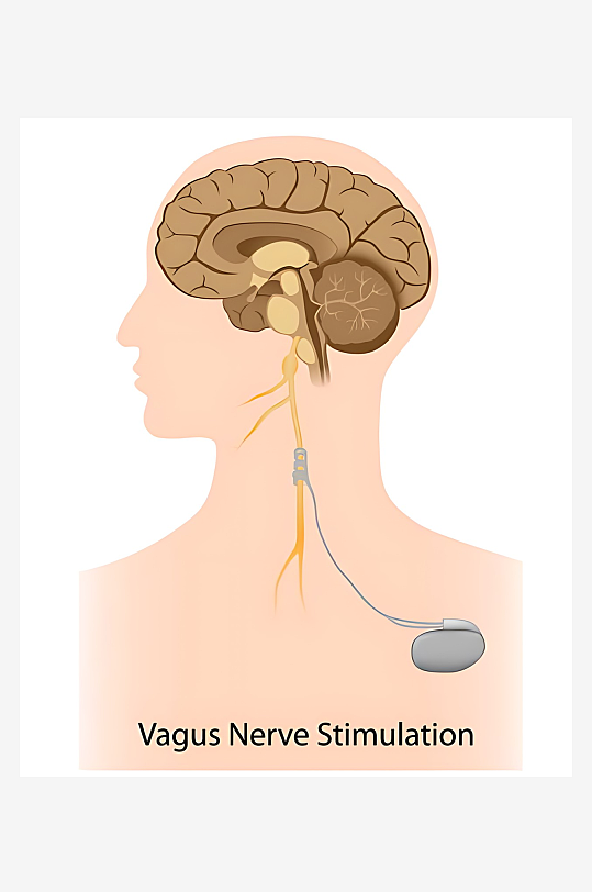 医疗医学人体示意图-众图网