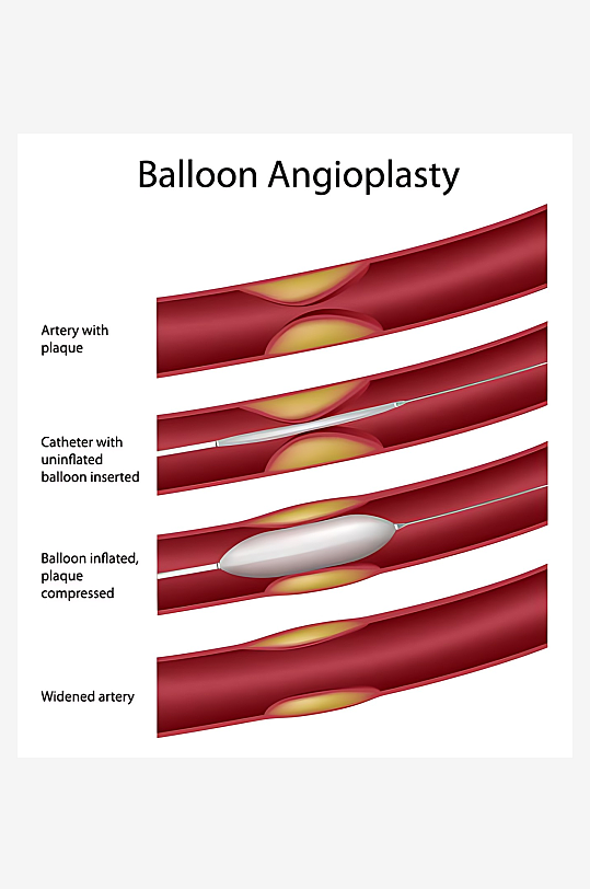 医疗医学人体示意图-众图网