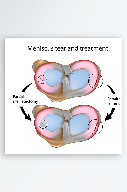 医疗医学人体示意图-众图网