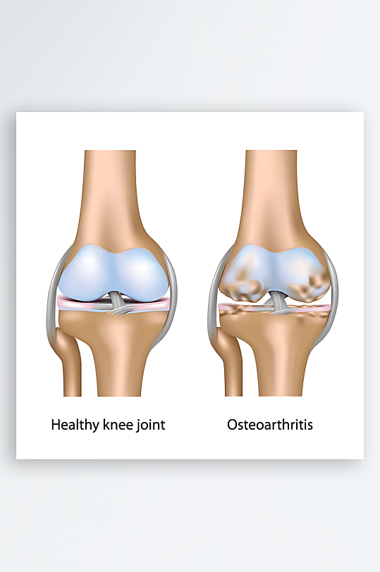 医疗医学人体示意图-众图网