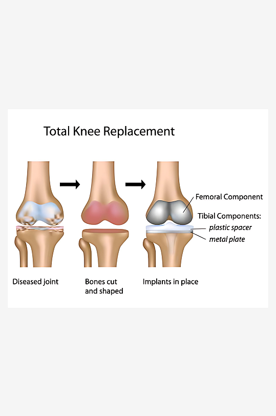 医疗医学人体示意图-众图网