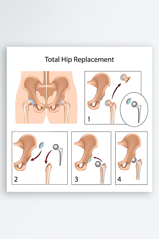 医疗医学人体示意图-众图网