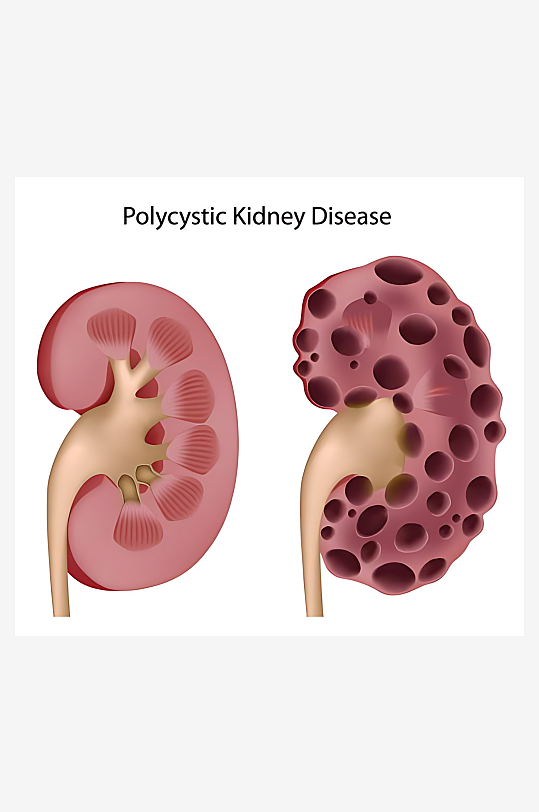 医疗医学人体示意图-众图网