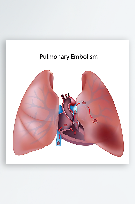 医疗医学人体示意图-众图网