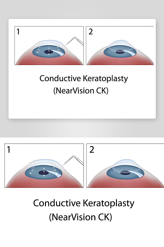 医学医疗人体示意图-众图网