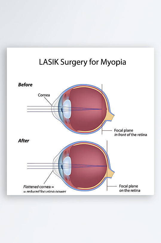 医学医疗人体示意图-众图网
