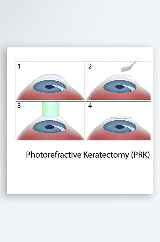 医学医疗人体示意图-众图网