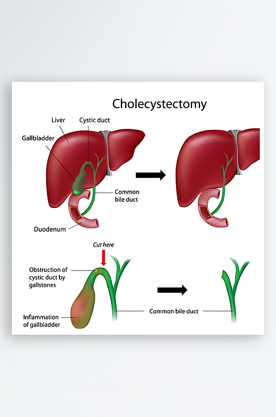 医学医疗人体示意图-众图网