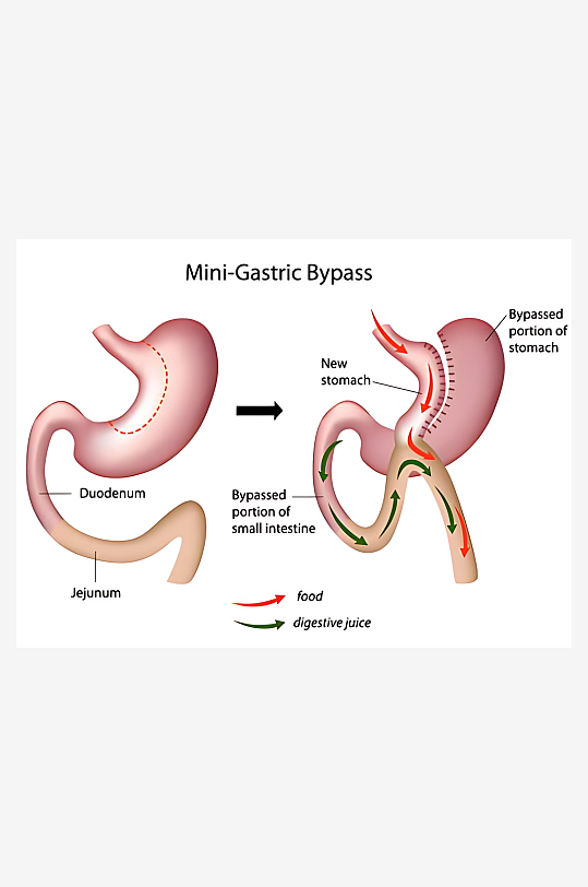 医学医疗人体示意图-众图网