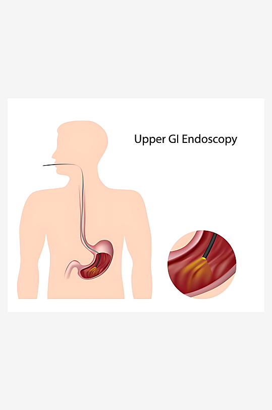 医学医疗人体示意图-众图网