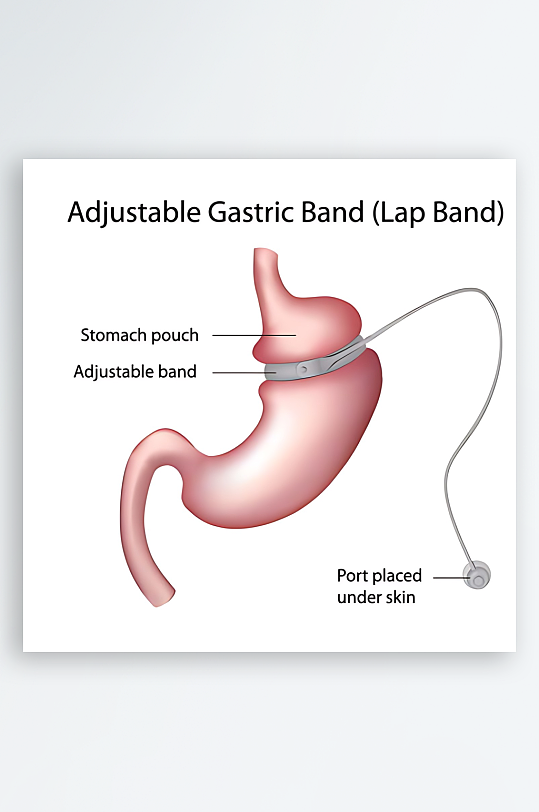 医学医疗人体示意图-众图网