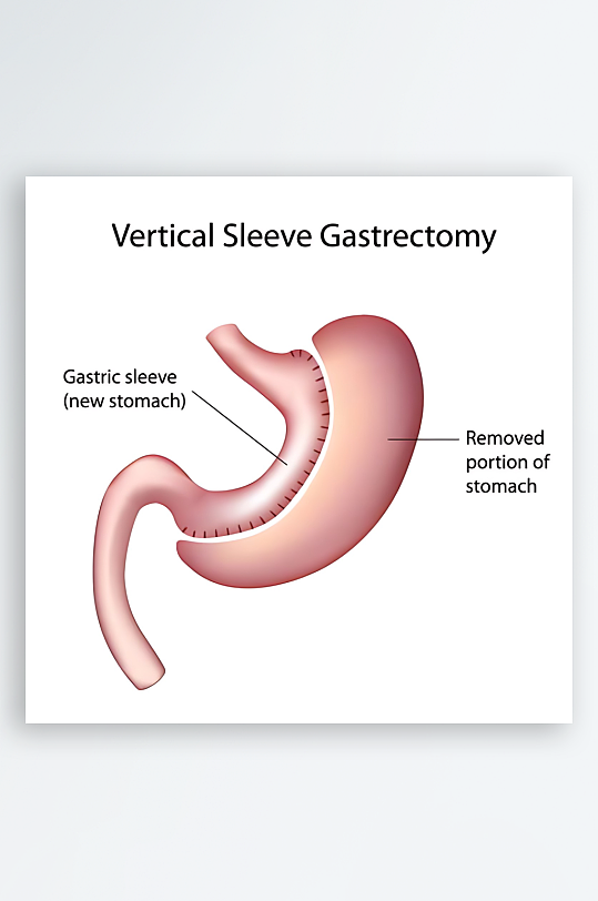 医学医疗人体示意图-众图网