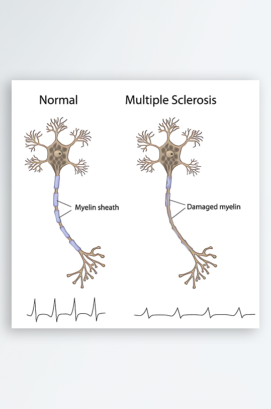 医学医疗人体示意图-众图网