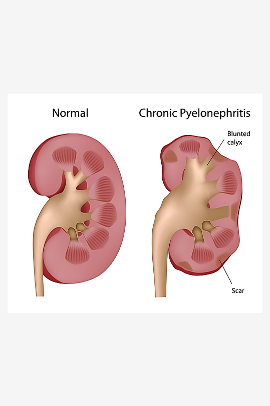 医学医疗人体示意图-众图网