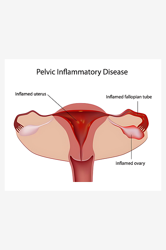医学医疗人体示意图-众图网