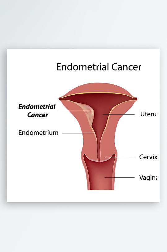 医学医疗人体示意图-众图网