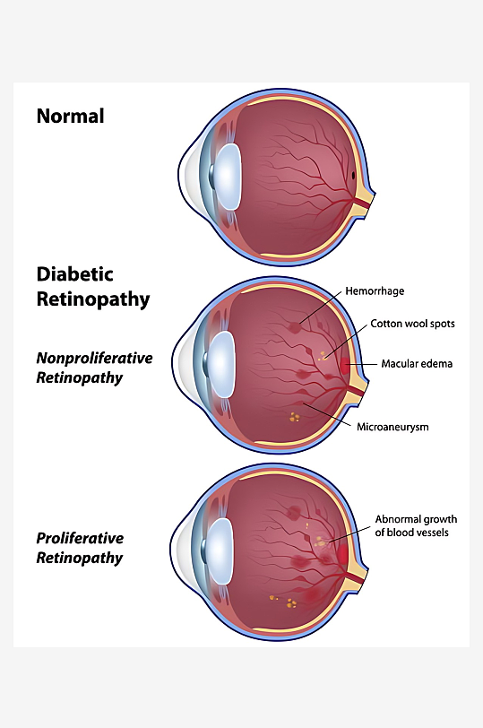医疗医学人体示意图-众图网