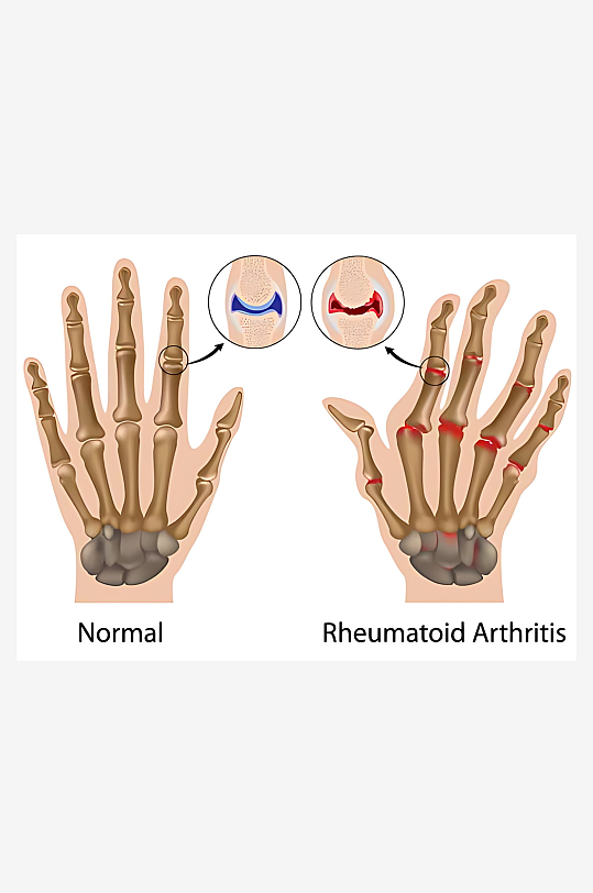 医疗医学人体示意图-众图网