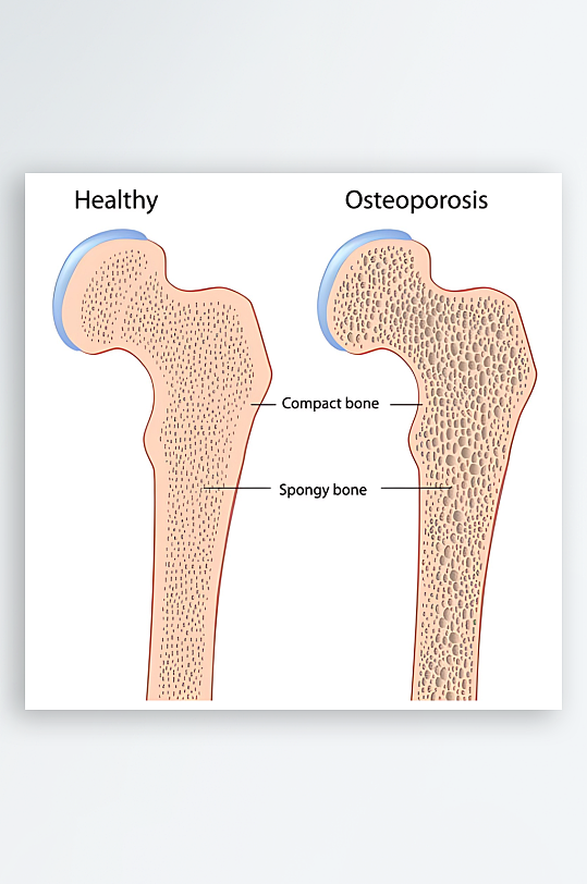 医疗医学人体示意图-众图网