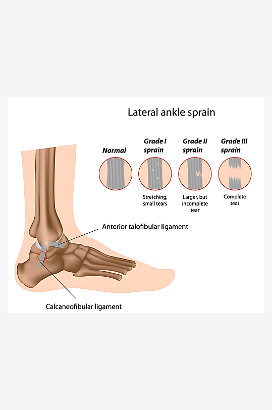 医疗医学人体示意图-众图网