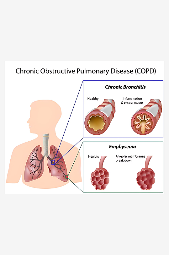 医疗医学人体示意图-众图网