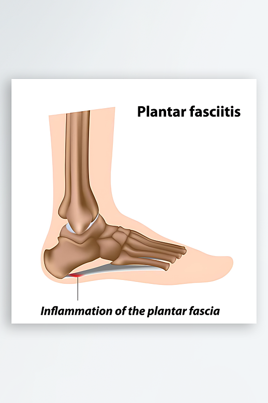 医疗医学人体示意图-众图网