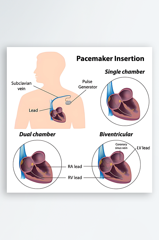 医疗医学人体示意图-众图网