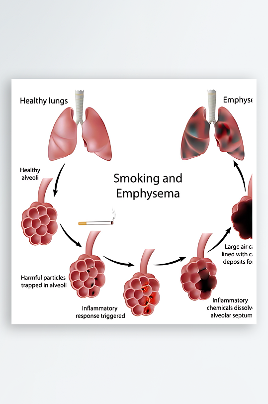 医疗医学人体示意图-众图网