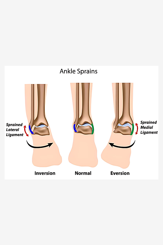 医疗医学人体示意图-众图网