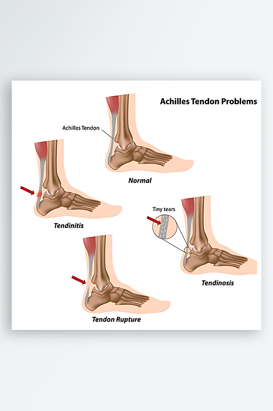 医疗医学人体示意图-众图网