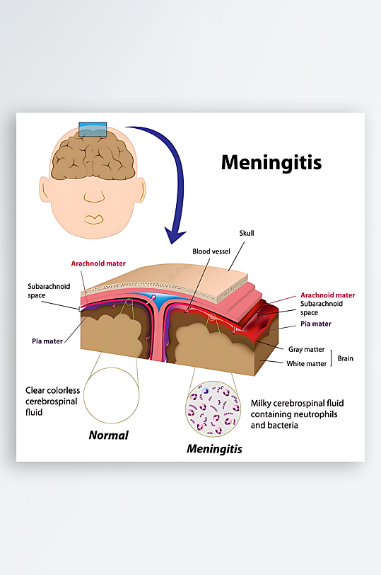 医疗医学人体示意图-众图网