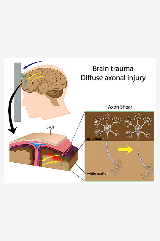 医疗医学人体示意图-众图网