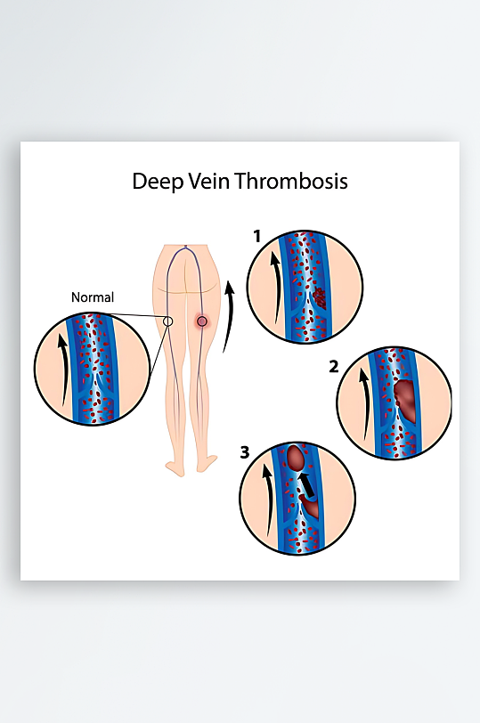 医疗医学人体示意图-众图网