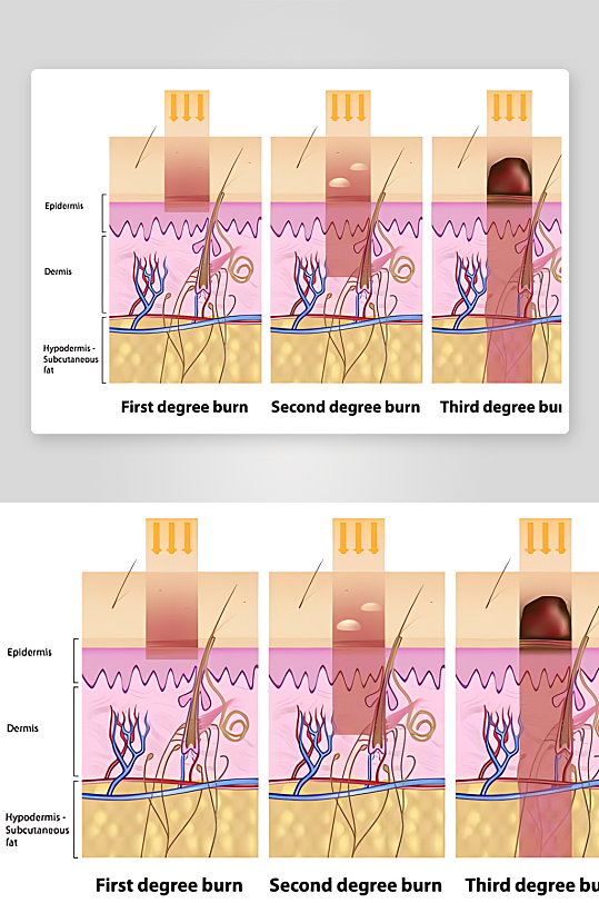 医学医疗人体示意图-众图网