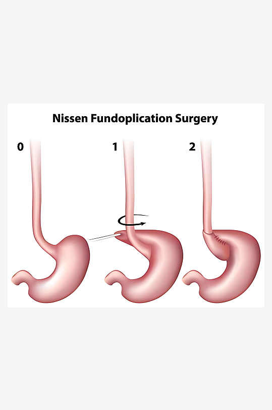 医学医疗人体示意图-众图网