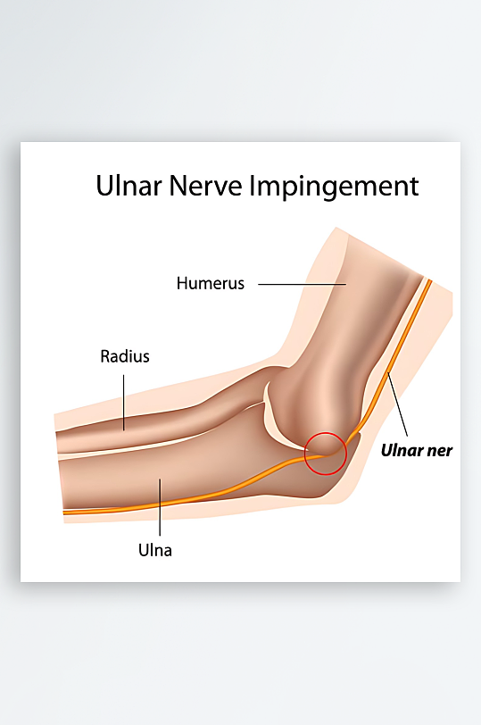 医学医疗人体示意图-众图网