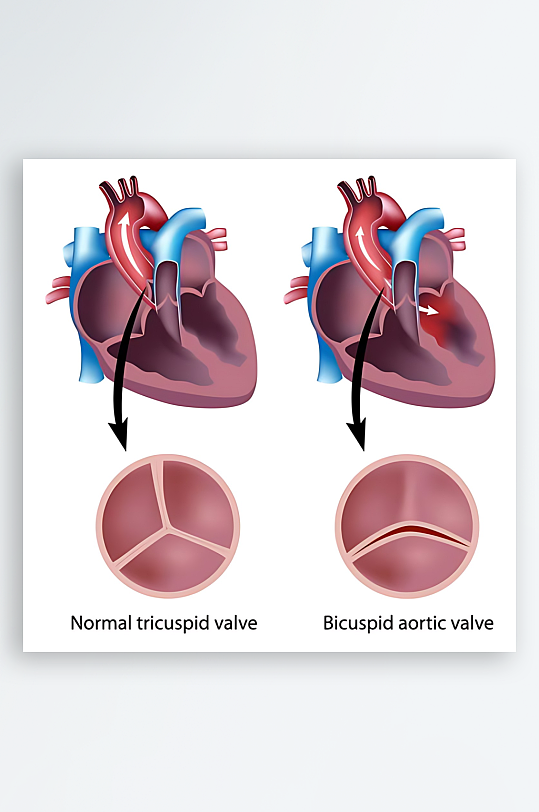 医学医疗人体示意图-众图网