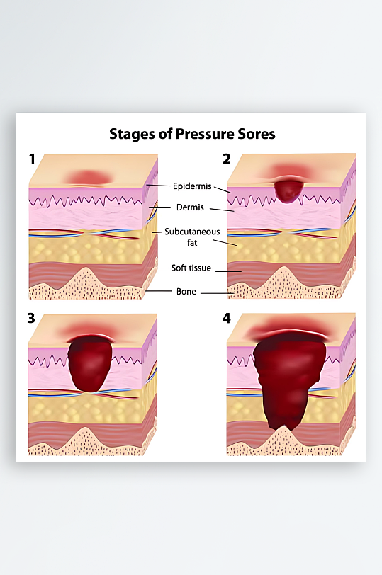 医学医疗人体示意图-众图网