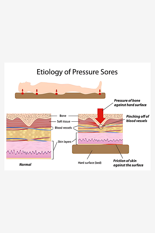 医学医疗人体示意图-众图网