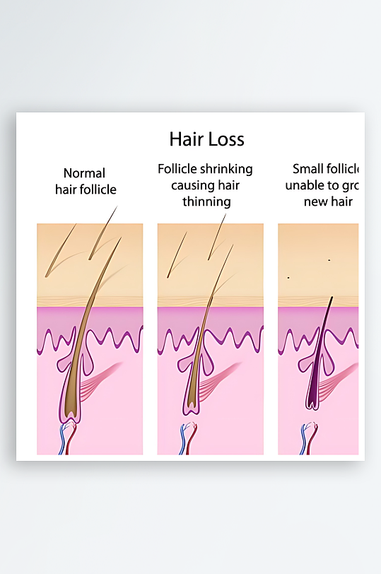 医学医疗人体示意图-众图网