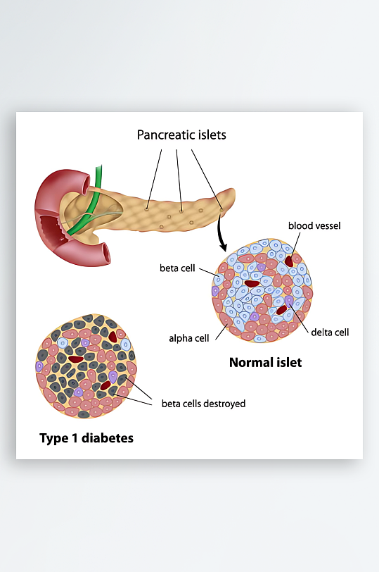 医学医疗人体示意图-众图网