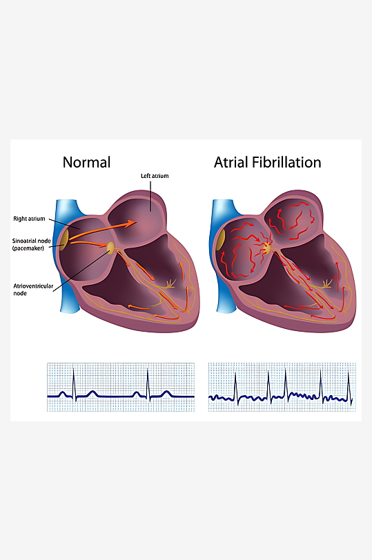 医学医疗人体示意图-众图网