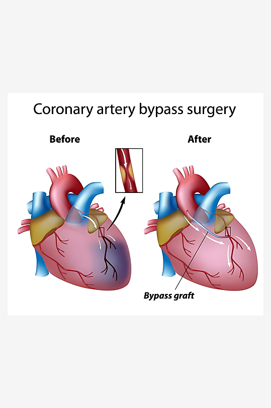 医学医疗人体示意图-众图网