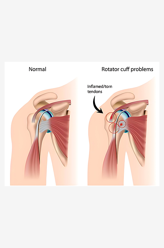 医学医疗人体示意图-众图网